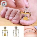 ابزار ارتودنسی ناخن