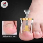 ابزار ارتودنسی ناخن